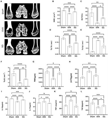 Shengu granules ameliorate ovariectomy-induced osteoporosis by the gut-bone-immune axis